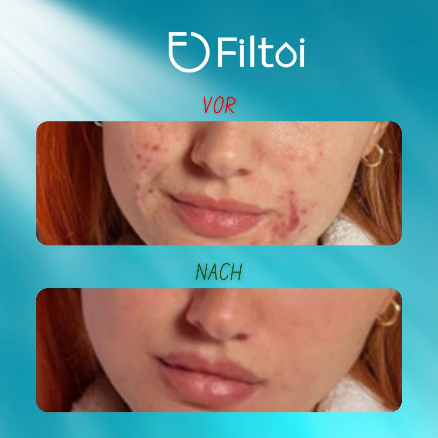 FILTOI™ Premium Wasserhahnfilter