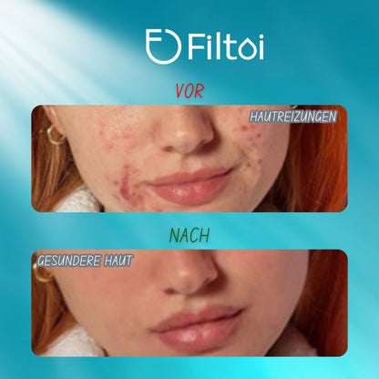 FILTOI™ Premium Wasserhahnfilter