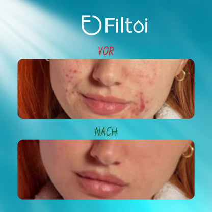 FILTOI™ Premium Wasserhahnfilter